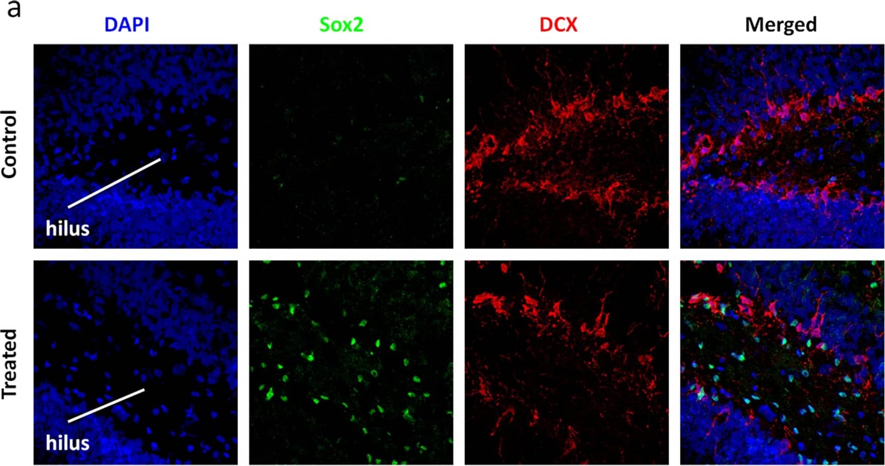 Immunocytochemistry/ Immunofluorescence SOX2 Antibody (245610) [Unconjugated]