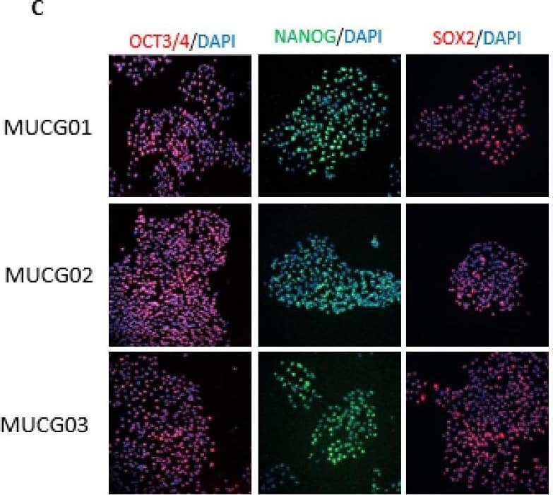 (A) Differentiation markers for the endoderm (FOXA2, PDX1), mesoderm ( alpha -actin, brachyury), and ectoderm ( beta 3 Tubulin, Otx2) were detected for the MUCG01, MUCG02, and MUCG03 clinical-grade hESC lines by immunocytochemistry. (B) Standard karyotypes without chromosomal aberration were detected for all hESC lines MUCG01: 46,XX; MUCG02: 46,XX; and MUCG03: 46,XY. (C) Pluripotency markers Oct3/4, Sox2, and Nanog were detected for the MUCG01, MUCG02, and MUCG03 clinical-grade hESC lines by immunocytochemistry. Image collected and cropped by CiteAb from the following open publication (//pubmed.ncbi.nlm.nih.gov/36293356), licensed under a CC-BY license. Not internally tested by R&D Systems.