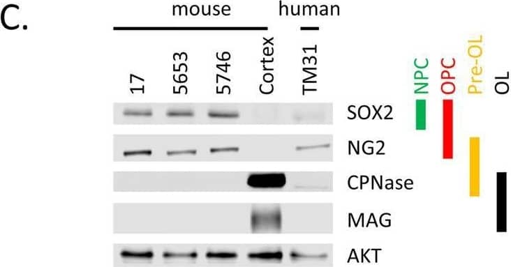 Characterization of cell lines.(A) H&E staining of tumor 5653, the arrow indicates the location of the tumor. The right panel shows a higher magnification. (B) Genotyping PCR on genomic wildtype mouse, genomic NPcis mouse (heterozygous for Nf1 and Tp53) DNA and DNA extracted from cell lines 17, 5653 and 5746. The glioma cell lines show complete loss of the wildtype allele for Nf1 and Tp53. (C) Western blot shows the expression of markers consistent with OPC lineage origin of our cell lines. SOX2 is expressed in Neural Progenitor cells (NPC) and Oligodendrocyte precursor cells (OPC); NG2 is expressed in OPCs. Markers (CPNase and MAG) expressed in pre-oligodendrocytes (pre-OL) or mature oligodendrocytes (OL) are not present, highlighting the progenitor status of our lines [22]. (D) The ATRX mutation (E2281*) present in TM31 was confirmed using sequencing. Top shows the reference genome DNA and protein sequence, bottom shows the TM31 sequence with STOP mutation. (E) The homozygous 4bp NF1 deletion (p.LF1247fs*18) present in TM31 was confirmed using sequencing. Top shows the reference genome DNA and protein sequence, bottom shows the TM31 sequence with the homozygous 4bp deletion inducing a frameshift. (F) Western blot for TP53 and CDKN2A, showing that both genes are absent in TM31, but not in glioma line LN319. Image collected and cropped by CiteAb from the following open publication (//pubmed.ncbi.nlm.nih.gov/36730269), licensed under a CC-BY license. Not internally tested by R&D Systems.