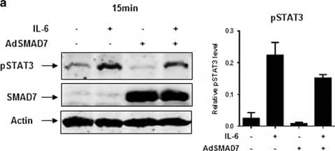 Adenovirus-mediated SMAD7 expression inhibits STAT3 phosphorylation in HuH-7. (a) Ectopic SMAD7 expression inhibits both endogenous and IL-6-induced STAT3 phosphorylation in HuH-7 cells. (b) Ectopic SMAD7 expression inhibits IL-6-induced MCL-1 expression in HuH-7 cells. Quantification of immunoblot analysis was performed of two independent experiments. One result is shown representatively. (c) IL-6 expression levels were investigated by RT–PCR upon ectopic SMAD7 expression. (d) Theoretical pathway connections between SMAD7 and STAT3 in HCC analyzed by cBioPortal analysis (//www.cbioportal.org/). Image collected and cropped by CiteAb from the following publication (//pubmed.ncbi.nlm.nih.gov/28134936), licensed under a CC-BY license. Not internally tested by R&D Systems.