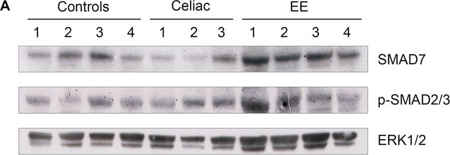 SMAD protein expression data from healthy controls, celiac disease, and environmental enteropathy.A) Representative western blot example investigating SMAD7; p-SMAD2,3 expression (using ERK1/2 as a normalizing protein) from controls (Ctl), celiac disease (CD), and environmental enteropathy (EE) patients. Note that for p-SMAD2,3, patients 3 and 4 have a double band that controls lacked. This band was likely an artifact and consequently was not considered in the densitometric analyses. B) Elevated SMAD7 densitometry levels in EE compared to controls (Ctl mean±SD = 0.47±0.20 a.u., EE = 1.13±0.25 a.u., p-value<0.05). Corresponds to WB5 (see S3 Table). C) Elevated p-SMAD2,3 densitometry levels in EE compared to controls (Ctl mean±SD = 0.38±0.14 a.u., EE = 0.60±0.10 a.u., p-value<0.05). Corresponds to WB2 (see S3 Table). D) Elevated p-SMAD2,3 densitometry levels in EE and CD compared to controls, with significant differences only between EE and controls (p-value<0.05) (Ctl mean±SD = 0.34±0.12 a.u., CD = 0.87±0.36 a.u., EE = 0.97±0.11 a.u.). Corresponds to WB1 (see S3 Table). Image collected and cropped by CiteAb from the following publication (//pubmed.ncbi.nlm.nih.gov/29415065), licensed under a CC-BY license. Not internally tested by R&D Systems.