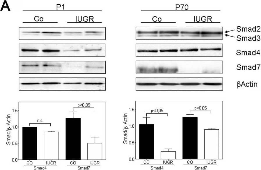 IUGR alters expression and phosphorylation of Smad proteins in rats.A: Representative immunoblots illustrating the expression of TGF-beta -specific Smad2, Smad3, the co-Smad, Smad4, and the inhibitory Smad, Smad7, in lungs extracted at days P1 and P70 from rats with and without IUGR.  beta -actin served as loading control. Immunoblot data were quantified for Smad4 and Smad7 for both days P1 and P70 (Co as black bar, and IUGR as white bar); n = 4–6 for each bar. The significance for each bar is indicated by p values, IUGR vs. CO; two-tailed Mann-Whitney test. B: The expression of active TGF-beta  signaling components in lung homogenates of rats with and without IUGR was analyzed by immunoblotting of phosphorylated (p) and total Smad2 and Smad3.  beta -actin served as loading control. Immunoblot data were quantified for pSmad2 and pSmad3 for both days P1 and P70 (Co as black bar, and IUGR as white bar); n = 4–6 for each bar. The significance for each bar is indicated by p values, IUGR vs. CO; two-tailed Mann-Whitney test. C: Immunhistochemical localization and expression pattern of pSmad2 and pSmad3 in lungs of rats with IUGR (right column) and without IUGR (left column). A–F: representative fields illustrating the expression and localization of pSmad2 in bronchi (A–D) and in the alveoli (E–F) of lungs extracted on day P70. G–L: representative fields illustrating the expression and localization of pSmad3 in bronchi (G–J) and in the alveoli (K–L) of lungs extracted on day P70. M–N: negative control. Image collected and cropped by CiteAb from the following open publication (//pubmed.ncbi.nlm.nih.gov/22028866), licensed under a CC-BY license. Not internally tested by R&D Systems.