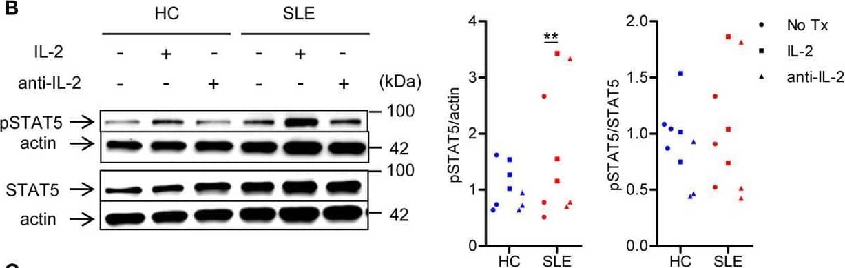 SLE CD4+ T cells are poised to activate IL-2 signaling during Treg differentiation. (A) Naïve CD4+ T cells were isolated from a systemic lupus erythematosus (SLE) patient & matched healthy control (HC) subject, & cultured for 3 days in the presence of anti-CD3/CD28 & TGF-beta  (5 ng/ml) with IL-2 (50 IU/ml) or anti-IL-2 (100 or 1,000 ng/ml). The frequency of CD4+CD25+FOXP3+ cells was determined by flow cytometry. Numbers below the plots represent the frequency of CD4+CD25+FOXP3+ Tregs. The dot plots on the left end represent isotype control staining. (B) CD4+ T cells isolated from matched SLE & HC subjects were cultured for 3 days in the presence of anti-CD3/CD28 & TGF-beta  (20 ng/ml) with or without IL-2 (100 IU/ml) or anti-IL-2 (100 ng/ml). Total STAT5 & its phosphorylation at tyrosine 694 were detected by immunoblotting. Representative immunoblot staining (left panel). The signal intensity of phospho-STAT5 & total STAT5 was normalized to that of actin. The normalized pSTAT5 signal intensity (middle panel) & the ratio of normalized pSTAT5 signal intensity over normalized STAT5 signal intensity (right panel) from 3 pairs of matched HC & SLE subjects. (C) Untouched T cells from matched SLE & HC subjects were cultured for 3 days without anti-CD3/CD28 stimulation. Expression of CD25 & FOXP3 in CD4+ cells were determined by flow cytometry. Representative flow cytometry dot plots are shown (left panel). Cumulative data of frequency of CD4+CD25+FOXP3+ & CD4+CD25+ cells, mean fluorescence intensity (MFI) of CD25 expression in CD4+ T cells, & the proportion of CD4+CD25+FOXP3+ cells among CD4+CD25+ cells from 17 pairs of matched SLE & HC subjects (right panel). Data were analyzed by a paired two-tailed t-test (*p<0.05, **p<0.01, ****p<0.0001). Image collected & cropped by CiteAb from the following open publication (//www.frontiersin.org/articles/10.3389/fimmu.2021.635531/full), licensed under a CC-BY license. Not internally tested by R&D Systems.