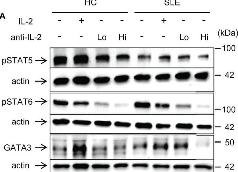 IL-2 induces STAT6 phosphorylation and GATA3 expression in systemic lupus erythematosus (SLE) CD8+ T cells. (A) CD8+ T cells from matched SLE and health control (HC) subjects were cultured as described in Figure 2. Expression of GATA-3 and phosphorylation of STAT5 at tyrosine 694 and STAT6 at tyrosine 641 were detected by immunoblotting. Representative immunoblot staining was presented. Lo and Hi concentrations of anti-IL-2 denote 100 and 1,000 ng/ml, respectively. (B) The signal intensity of phospho-STAT5, phospho-STAT6, and GATA-3 were normalized to that of actin. Cumulative data from 9 pairs of matched HC and SLE subjects. Data were analyzed by a two-tailed t-test (*p<0.05, **p<0.01, ***p<0.001). (C) Pearson’s and Spearman’s correlation analyses were performed to determine the association between the expression of cytokines (IL-13, IL-5, and IFN-gamma ) and transcription factors (phospho-STAT5, phospho-STAT6, and GATA-3). The blue and red plots represent data from HC and SLE patients, respectively. Spearman correlation coefficient was presented for the association between IL-13 and phospho-STAT5, IL-5 and phospho-STAT-5, and IFN-gamma  and GATA-3. Pearson correlation coefficient was presented for the remainder of associations. Image collected and cropped by CiteAb from the following open publication (//www.frontiersin.org/articles/10.3389/fimmu.2021.635531/full), licensed under a CC-BY license. Not internally tested by R&D Systems.