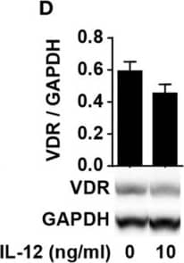 IL-12 does not inhibit 1,25(OH)2D3 production or VDR expression and function in CD4+ T cells. Relative CYP27B1 (A), VDR (C), and CYP24A1 (E) expression in T cells activated for 72 h in the presence of 100 nM 25(OH)D3 and the indicated concentration of IL-12. Data are normalized to activated T cells incubated with 100 nM 25(OH)D3 in the absence of IL-12 (mean + SEM, n ≥ 6). (B) 1,25(OH)2D3 production in T cells activated for 72 h in the presence of 100 nM 25(OH)D3 and the indicated concentration of IL-12 (mean + SEM, n ≥ 4). (D) Representative Western blot (lower panel) and quantification (upper panel) of VDR with GAPDH as loading control from T cells activated for 72 h in the presence of 100 nM 25(OH)D3 and in the presence or absence of 10 ng/ml IL-12 (mean + SEM, n = 4). Western blots including protein ladder are shown in the Figure S1 in Supplementary Material. Image collected and cropped by CiteAb from the following open publication (//pubmed.ncbi.nlm.nih.gov/28620394), licensed under a CC-BY license. Not internally tested by R&D Systems.