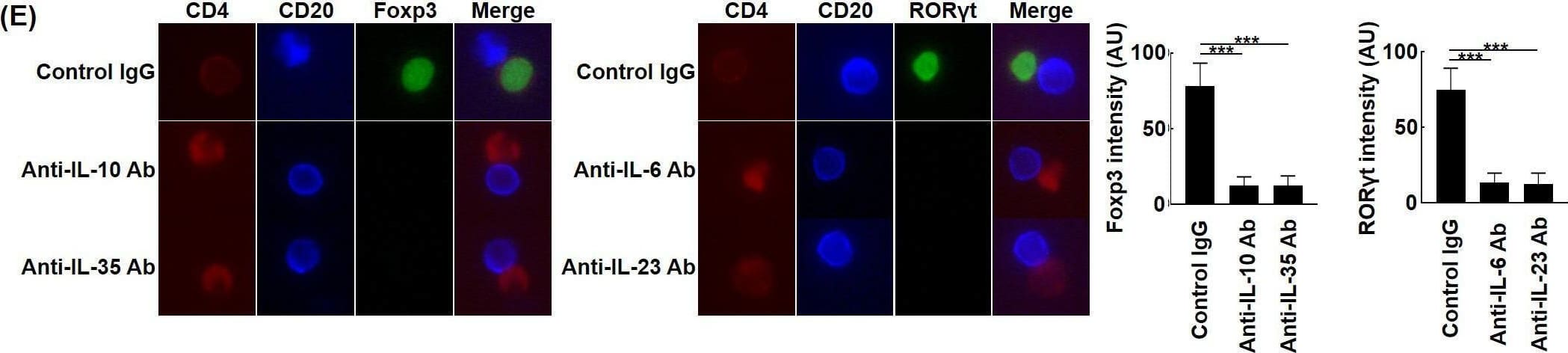 Effects of topo I-reactive B cells on the differentiation of CD4+ T cells in systemic sclerosis (SSc) patients.B cells with low affinity for topo I and those with high affinity for topo I as well as topo I-non-reactive B cells were obtained from anti-topo I antibody-positive SSc patients (n = 111). These B cells were co-cultured with CD4+ T cells. After 48 hr of co-culture, mRNA was extracted from these cells and FoxP3 and ROR gamma t expression levels were examined by real-time RT-PCR. The results were presented when 96-well plates were used as a co-culture site (A) and when microculture plates (B) were used (C). These cells were further co-cultured on microculture plates, and the protein expression of CD4, CD20, FoxP3, and ROR gamma t was confirmed by fluorescent cell staining and signal intensity was determined by ImageJ (D). Similarly, co-culture in microculture plates in the presence of anti-IL-10 (10 μg/ml), anti-IL-35 (5 μg/ml), anti-IL-6 (1 μg/ml), or anti-IL-23 (5 μg/ml) antibodies (Abs) was conducted, followed by fluorescent cell staining (E). These results represented seven experiments. The bar graphs show the mean + SD. Original magnification, ×1000. *p<0.05.Figure 3—source data 1.Source file for the effects of topo I-reactive B cells on the differentiation of CD4+ T cells in systemic sclerosis (SSc) patients.This archive contains all data used for the quantitative analysis shown in Figure 3.Source file for the effects of topo I-reactive B cells on the differentiation of CD4+ T cells in systemic sclerosis (SSc) patients.This archive contains all data used for the quantitative analysis shown in Figure 3. Image collected and cropped by CiteAb from the following open publication (//pubmed.ncbi.nlm.nih.gov/34854378), licensed under a CC-BY license. Not internally tested by R&D Systems.