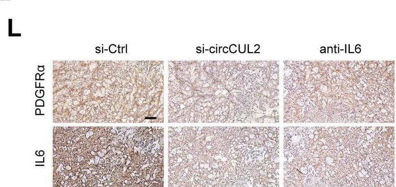 circCUL2-overexpression NFs promote PDAC progression in vivo. A Representative Bioluminescence images, lung and HE staining of lung tissue of mice 4 weeks after tail vein injection of luc-PANC-1 cell treated with conditioned medium as indicated (n = 8 per group). Scale bar, 100 μm. B Relative luminescence intensity in each group. C Histogram analysis of the metastatic nodules number in per lung. D lung metastasis rate of each group (Chi-square test). E-F Representative bioluminescence images and histogram analysis of luminescence intensity in each at day 30 are shown (n = 6). G Abdominal metastasis rate was calculated for indicated group (Chi-square test). H Representative images of orthotopic model in each group on which autopsy was performed. Red arrow indicated primary tumor; S, spleen; T, primary tumor; M, metastasis. I Images of PDX from 2 patients in 5 mice. (J) Tumor growth curves of indicated group (n = 5). K qRT–PCR analysis of circCUL2 levels in PDX of mice before and after treatment. L Representative images of IHC for PDGFR alpha  and IL6. Scale bar, 100 μm. Data are expressed as the mean ± SD. **p < 0.01 and ***p < 0.001 (two-tailed Student t-tests) Image collected and cropped by CiteAb from the following open publication (//pubmed.ncbi.nlm.nih.gov/35189958), licensed under a CC-BY license. Not internally tested by R&D Systems.