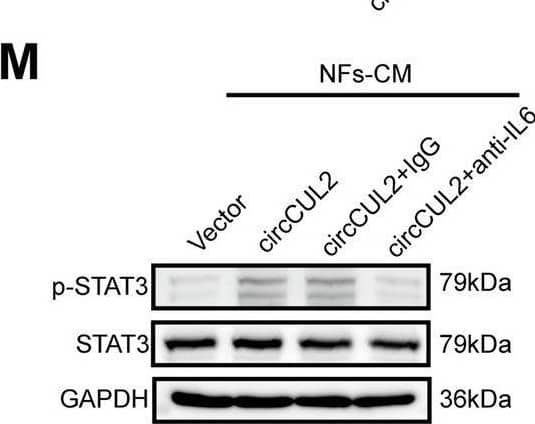 circCUL2 regulates the phenotypic plasticity of CAFs and promote PDAC progression by IL6. A Gene Set Enrichment Analysis (GSEA) of affected signatures in fibroblasts (circCUL2 vs. control). B GSEA plots for inflammatory CAF (iCAF) signatures in circCUL2 overexpression NFs from control. C-D qRT–PCR analysis of iCAF markers (IL6, TNF-alpha  and IL1 alpha ) and myCAF marker (Acta2 and Axin2) expression in circCUL2 overexpression NFs. E Flow cytometric analysis of PDGFR alpha  and  alpha -SMA expression in circCUL2 overexpression NFs. F-H. Representative cytokine arrays for circCUL2-overexpression NFs and control (n = 3). arrows indicate the cytokines with significant changes, which were further confirmed by qRT–PCR and ELISA. I-L EdU assay (I), colony formation (J), Scratch wound healing assays (K) and transwell assays (L) of PANC-1 cells treated with conditioned medium circCUL2-overexpression NFs or anti-IL6. Scale bar, 100 μm. M western blot analysis of STAT3 and p-STAT3 in PANC-1 cells. Data are expressed as the mean ± SD of three independent experiments. **p < 0.01 and ***p < 0.001 (two-tailed Student t-tests) Image collected and cropped by CiteAb from the following open publication (//pubmed.ncbi.nlm.nih.gov/35189958), licensed under a CC-BY license. Not internally tested by R&D Systems.