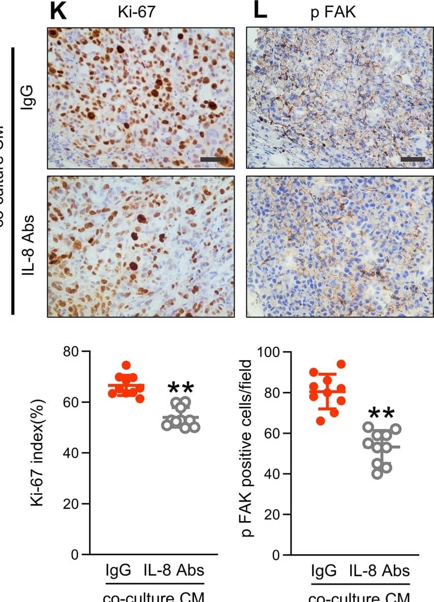 Immunohistochemistry CXCL8/IL-8 Antibody (6217) [Unconjugated]