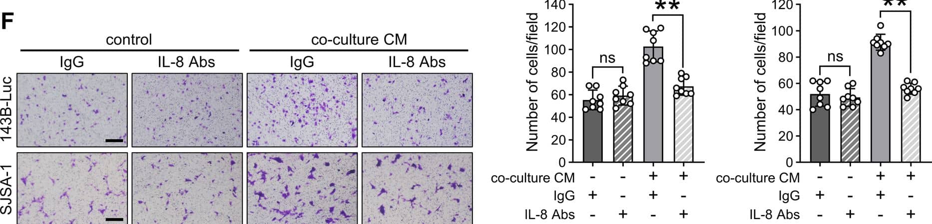 Immunohistochemistry CXCL8/IL-8 Antibody (6217) [Unconjugated]