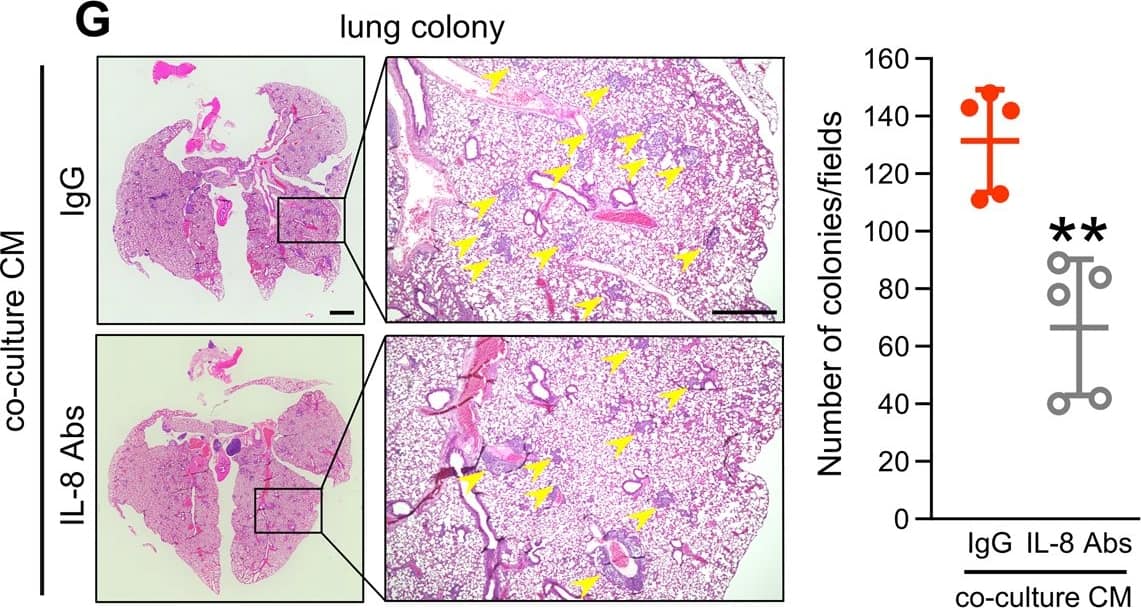 Immunohistochemistry CXCL8/IL-8 Antibody (6217) [Unconjugated]