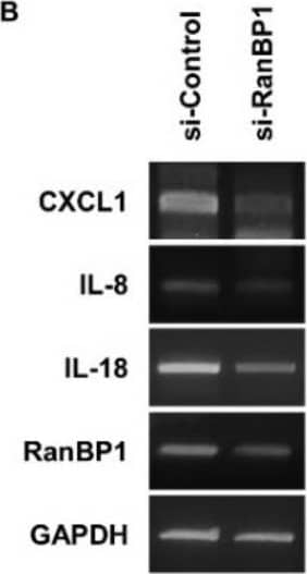 Western Blot CXCL8/IL-8 Antibody (6217) [Unconjugated]