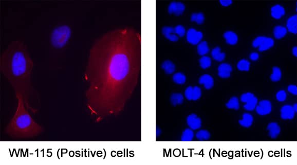 GDNF was detected in immersion fixed WM‑115 Human Malignant Melanoma Cell Line (positive) and MOLT‑4 Human Acute Lymphoblastic Leukemia Cell Line (negative) Cells using Mouse Anti-Human GDNF Monoclonal Antibody (Catalog # MAB2121) at 8 µg/mL for 3 hours at room temperature. Cells were stained using the NorthernLights™ 557-conjugated Anti-Mouse IgG Secondary Antibody (red; Catalog # NL007) and counterstained with DAPI (blue). Specific staining was localized to cell surface and cytoplasm. View our protocol for Fluorescent ICC Staining of Cells on Coverslips.