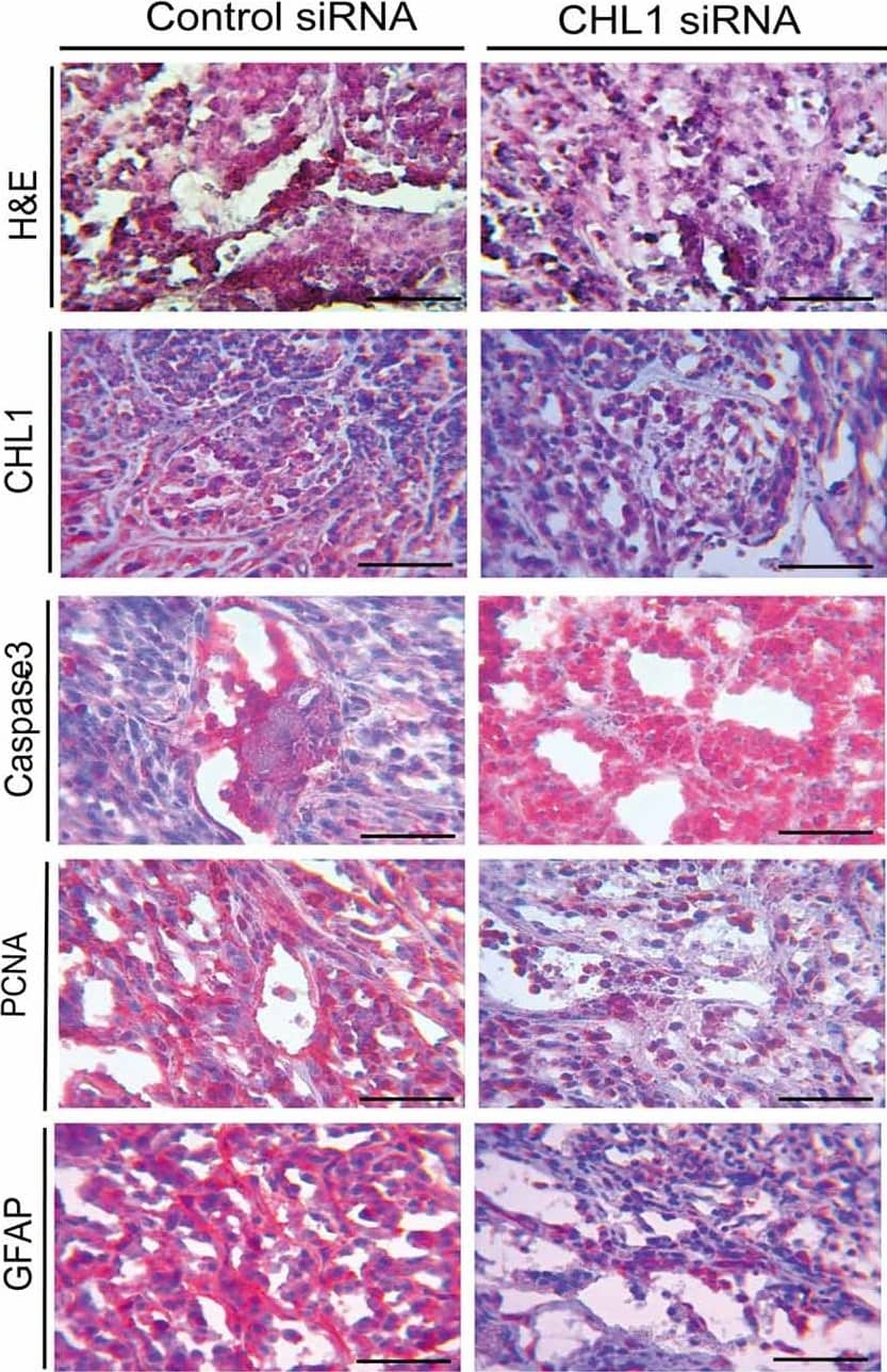 H&E staining and immunohistochemical staining analyses for the CHL1, caspase-3, PCNA and GFAP molecules in glioblastoma xenograft tissues from both control siRNA and CHL1 siRNA-treated groups. Scale bars represent 25 μm. Image collected and cropped by CiteAb from the following publication (//journal.frontiersin.org/article/10.3389/fnmol.2017.00324/full), licensed under a CC-BY license. Not internally tested by R&D Systems.