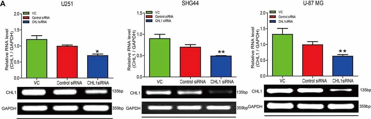 Treatment of siRNA targeting CHL1 in three human glioma cell lines. Total RNA was isolated from U251, SHG44 and U-87 MG cells treated with vehicle control (vc), control siRNA (control siRNA) or siRNA targeting CHL1 (CHL1 siRNA). RT-PCR and Western blot analysis were then used to measure both relative mRNA and protein levels of CHL1. (A) RT-PCR analysis of the mRNA levels of CHL1 in U251, SHG44 and U-87 MG cells treated with vehicle control (vc), control siRNA and siRNA targeting CHL1, and (B) Western blot analysis of the protein levels of CHL1 detected in U251, SHG44 and U-87 MG cells treated with vehicle control (vc), control siRNA and siRNA targeting CHL1. Data are presented as means ± standard error of the mean (SEM) (n = 3, *p < 0.05; **p < 0.01, independent Student’s t-test). Image collected and cropped by CiteAb from the following publication (//journal.frontiersin.org/article/10.3389/fnmol.2017.00324/full), licensed under a CC-BY license. Not internally tested by R&D Systems.