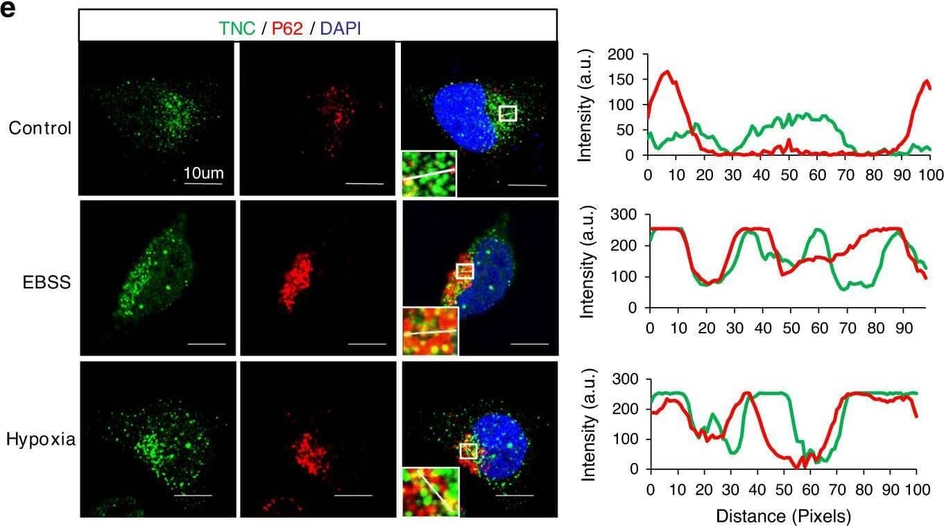 P62 mediates selective autophagic degradation of TNC.a Immunoblot of MDA-MB-231-WT or MDA-MB-231-Atg5KO#4 cells treated with EBSS for the indicated time points. b HEK293T cells were transfected with Flag-tagged p62, NDP52, NBR1, TAX1BP1, Tollip, OPTN or BNIP3L, followed by immunoprecipitation with anti-Flag beads and immunoblot analysis with anti-TNC. c Coimmunoprecipitation and immunoassay of extracts of HEK293T cells transfected with FLAG-tagged wild-type p62 or its UBA domain deletion mutant, together with HA-tagged TNC. d Immunoprecipitation and immunoassay of extracts HEK293T cells transfected with Flag-p62, HA-TNC, and treated with EBSS for different hours. e Confocal microscopy of MDA-MB-231 cells treated with EBSS for 3 h or exposed to hypoxia for 12 h in the presence of BafA1. Scar bar, 10 µm. Line-scan analysis for each image is also shown. Green, TNC; Red, P62. f HEK293T cells were transiently transfected with p62 siRNA for 12 h, then co-transfected with HA-tagged TNC for another 48 h. Then the cells were treated with EBSS for different hours. g Construct deletion mutants of Flag-TNC according to the conserved domains of TNC. h HEK293T cells were transfected with Flag-tagged TNC or deletion mutants. Endogenous p62 was immunoprecipitated and the bound Flag-TNC proteins examined by immunoblot. All data are representative of three independent experiments. Image collected and cropped by CiteAb from the following open publication (//pubmed.ncbi.nlm.nih.gov/32732922), licensed under a CC-BY license. Not internally tested by R&D Systems.