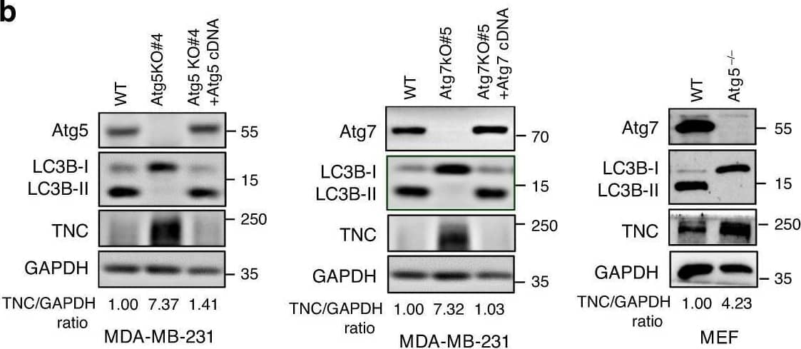 TNC is overexpressed in autophagy-deficient TNBC cells and inhibits T-cell priming. A The Top10 KEGG pathways enriched for commonly upregulated proteins in MDA-MB-231-Atg5KO#4 cells and MEF-Atg5−/− cells compared to control cells. b Immunoassay of extracts of the indicated MDA-MB-231 cells and MEF cells. c The indicated MDA-MB-231 cells were co-cultured with CD3/CD28- activated human T-lymphocyte cells. Upper, representative dot plots of the cleavage of caspase-3 in tumour cells measured by flow cytometry. Bottom, percentage of the cleaved caspase-3 in tumour cells (n = 3 biological independent samples). d The effect of TNC knockout in 4T1-Atg5KO cells using CRISPR-Cas9 technology. e Tumour growth of indicated mouse 4T1-Atg5KO#1 cells in BALB/c mice (n = 5 mice per group). Tumour volumes were calculated (left), and tumour weights from experiment on autopsy on day 27 (right). f FACS analysis of CD45+CD4+, CD45+CD8+, and IFN gamma + in CD45+CD4+T and CD45+CD8+T-cell populations from the isolated TILs in (e) (n = 5 mice per group, right). Representative dot plots from a representative mouse for each group (left). Error bars represent mean ± SEM. The P value in c was determined by one-way ANOVA with Tukey’s multiple comparisons test, no adjustments were made for multiple comparisons. The P value in e, f was determined by a two-tailed unpaired Student’s t test. NS no significance. All data are representative of three independent experiments. Image collected and cropped by CiteAb from the following open publication (//pubmed.ncbi.nlm.nih.gov/32732922), licensed under a CC-BY license. Not internally tested by R&D Systems.