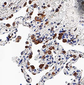 G‑CSF was detected in immersion fixed paraffin-embedded sections of lung using Mouse Anti-Human G‑CSF Monoclonal Antibody (Catalog # MAB2142) at 5 &micro;g/mL for 1 hour at room temperature followed by incubation with the Anti-Mouse IgG VisUCyte&trade; HRP Polymer Antibody (Catalog # VC001). Before incubation with the primary antibody, tissue was subjected to heat-induced epitope retrieval using VisUCyte Antigen Retrieval Reagent-Basic (Catalog # VCTS021). Tissue was stained using DAB (brown) and counterstained with hematoxylin (blue). Specific staining was localized to monocytes. View our protocol for IHC Staining with VisUCyte HRP Polymer Detection Reagents.