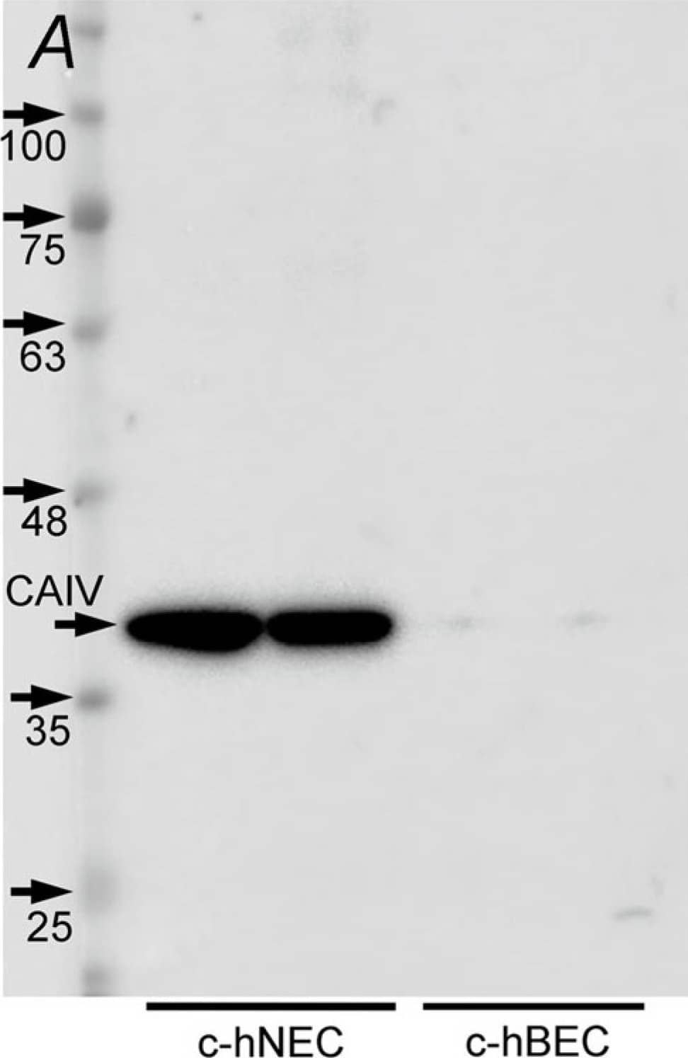 Western Blot Carbonic Anhydrase IV/CA4 Antibody (310413) [Unconjugated]