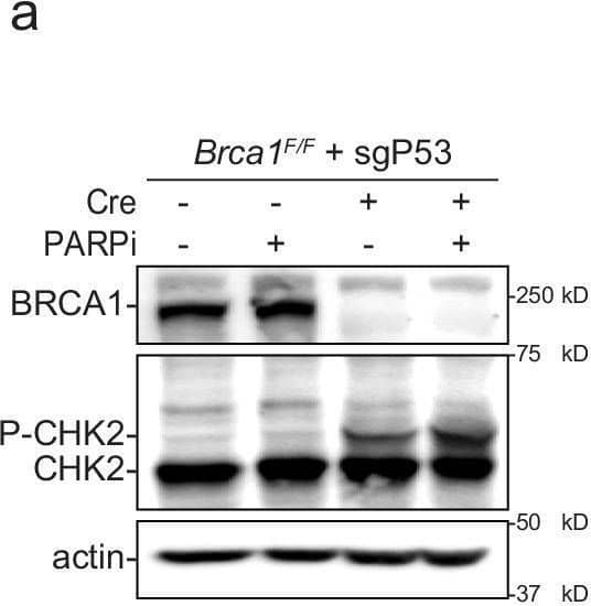 Microtubule-dependent nuclear deformations and DSBs mobility. A Immunoblot for BRCA1, CHK2 and phospho-CHK2 (P-CHK2) in p53-deleted (sg-P53) Brca1F/F Mouse Embryonic Fibroblasts (MEFs) 72 h after transduction with Hit&Run Cre and/or 6 h treatment with PARPi (0.5 μM). Actin is shown as loading control. b Examples of 10 min traces of mCherry-BP1-2 foci in Brca1F/F MEFs 72 h after Brca1 deletion, 6 h after PARPi addition in the absence or presence of taxol (1 h) or nocodazole (2 h). Scale bars: 10 μm. c MSD of mCherry-BP1-2 foci in the indicated MEFs as described in (b), with SD. Total foci analyzed: 1618 for DMSO, 1056 for taxol, and 1085 for nocodazole from 35, 30, 28 nuclei, respectively from n = 3 independent experiment. d Representative image of Brca1F/F MEFs without any treatment or 72 h after Cre-mediated deletion of Brca1, PARPi treatment for 6 h treatment and/or incubation with taxol for 1 h. Highlighted boxes indicate nuclear deformations as vertical invaginations (blue), light (green) and deep (yellow) lateral invaginations, and longitudinal invaginations (magenta). In black and gray boxes, the control nuclear edges and nuclear interior with no invaginations, respectively. Scale bars: 2 μm. Magnification ×4.25. (e) Quantification of nuclear deformations as in (d) from 40, 20 and 22 cells for each condition derived from one representative experiment. Statistical analysis by Kruskal–Wallis test for multiple comparisons. (*) P < 0.05 (p = 0.0381); P ≧ 0.05 are not significant. Source data are provided as a Source Data file. See also Supplementary Fig. 1. Image collected and cropped by CiteAb from the following open publication (//pubmed.ncbi.nlm.nih.gov/40527886), licensed under a CC-BY license. Not internally tested by R&D Systems.