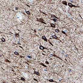 NF‑L was detected in immersion fixed paraffin-embedded sections of human brain (hippocampus) using Mouse Anti-Human NF‑L Monoclonal Antibody (Catalog # MAB22164) at 5 &micro;g/mL for 1 hour at room temperature followed by incubation with the Anti-Mouse IgG VisUCyte&trade; HRP Polymer Antibody (VC001). Before incubation with the primary antibody, tissue was subjected to heat-induced epitope retrieval using Antigen Retrieval Reagent-Basic (CTS013). Tissue was stained using DAB (brown) and counterstained with hematoxylin (blue). Specific staining was localized to cytoplasm in neurons. Staining was performed using our protocol for IHC Staining with VisUCyte HRP Polymer Detection Reagents.