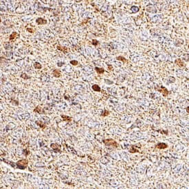 Olig 1, 2, 3 was detected in immersion fixed paraffin-embedded 13 d.p.c. sections of Mouse Embryo using Mouse Anti-Human Olig 1, 2, 3 Monoclonal Antibody (Catalog # MAB2230) at 15 &micro;g/mL for 1 hour at room temperature followed by incubation with the Anti-Mouse IgG VisUCyte&trade; HRP Polymer Antibody (Catalog # VC001). Before incubation with the primary antibody, tissue was subjected to heat-induced epitope retrieval using VisUCyte Antigen Retrieval Reagent-Basic (Catalog # VCTS021). Tissue was stained using DAB (brown) and counterstained with hematoxylin (blue). Specific staining was localized to nuclei in neurons in developing brain. View our protocol for IHC Staining with VisUCyte HRP Polymer Detection Reagents.