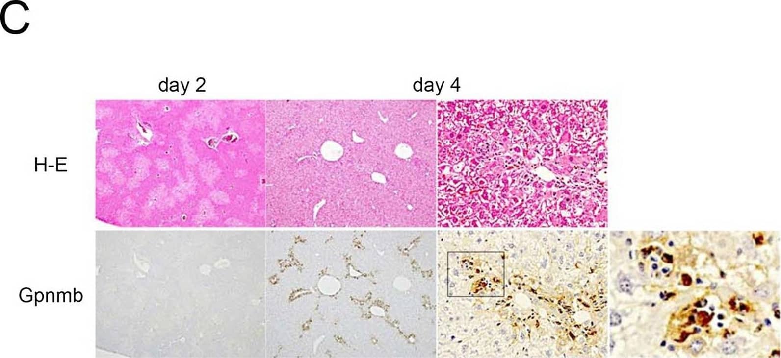 Sequential changes in and localization of Gpnmb expression. Gpnmb expression is enhanced in the recovery phase (A) in whole liver as determined by Western blotting and (B) in isolated hepatic macrophages as determined by quantitative real-time polymerase chain reaction (n = 5 at each day). (C) Moreover, Gpnmb expression is observed immunohistochemically around injured lesions in a pattern similar to that in F4/80-positive macrophages, and Gpnmb-positive cells exhibit partial phagocytosis. Image collected and cropped by CiteAb from the following open publication (//pubmed.ncbi.nlm.nih.gov/26599547), licensed under a CC-BY license. Not internally tested by R&D Systems.