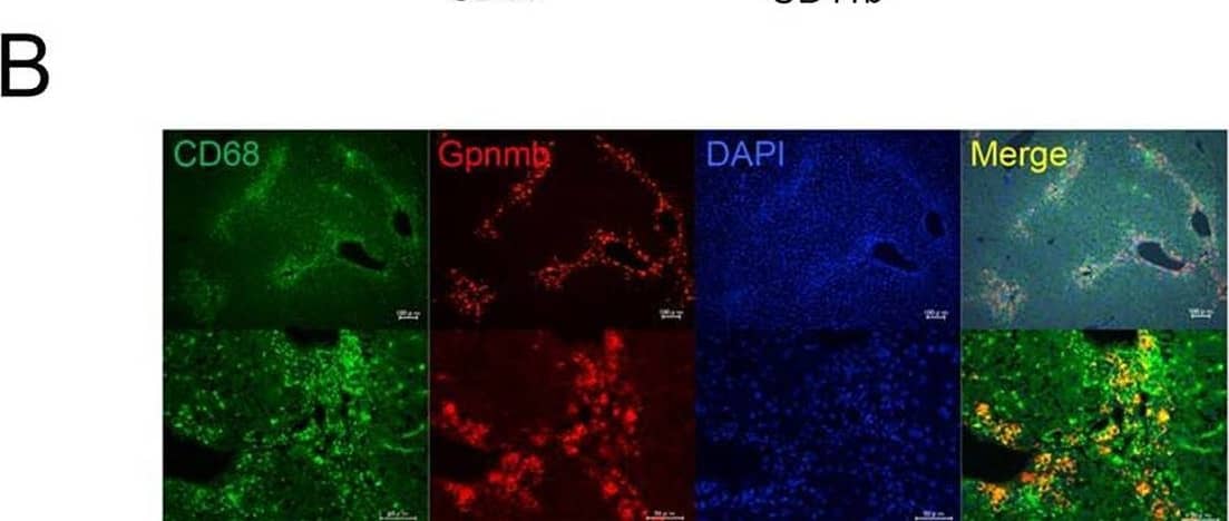 Characteristics of gpnmb-positive cells infiltrating liver tissue. In LMNCs isolated from injured liver, (A) more than 90% of hepatic macrophages positive for F4/80 are also positive for CD68, whereas CD11b is expressed in approximately 10% of F4/80-positive cells. Gpnmb expression is detected in approximately 50% of CD68-positive cells. (B) Immunofluorescent double staining shows that some CD68-positive cells are also positive for Gpnmb (scale bar: upper, 100 μm; lower, 50 μ m). (C) Some Gpnmb-positive cells show phagocytosis of apoptotic cells (scale bar: left side, 100 μm; right side, 50 μm). (D) Phagocytic activity of CD68-positive cells is significantly higher than that of CD11b-positive cells. Additionally, in CD68-positive cells, phagocytic activity of Gpnmb-positive cells is significantly increased compared with that in Gpnmb-negative cells. Values are mean ± SEM (n = 3). * P < 0.05 (Mann-Whitney U test). Image collected and cropped by CiteAb from the following open publication (//pubmed.ncbi.nlm.nih.gov/26599547), licensed under a CC-BY license. Not internally tested by R&D Systems.
