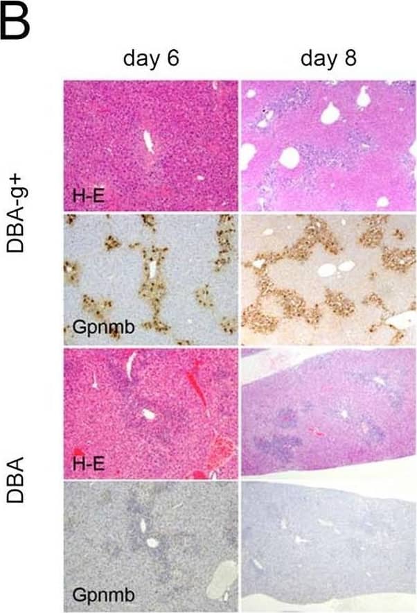 Features of DBA-g+ and DBA mice.(A) Expression of Gpnmb is observed in DBA-g+ but not DBA mice following a single injection of CCl4. However, (B) sequential changes in serum ALT levels and the degree of liver injury are not affected by the lack of Gpnmb-positive macrophages (original magnification, x100). Conversely, (C) the areas of fibrosis and (D) the number of  alpha -SMA-positive cells are significantly decreased in the liver tissues of DBA mice compared to DBA-g+ mice (original magnification, x200). Additionally, (E) although lack of Gpnmb-positive macrophages does not affect expression of TGF-beta  or Col1 alpha 1, expression of MMP-9, MMP-13, and TIMP-1 are significantly decreased in mice lacking Gpnmb expression at six or eight days after single injection of CCl4. Values are mean ± SEM (n = 4). * P < 0.05 (Mann-Whitney U test). Image collected and cropped by CiteAb from the following open publication (//pubmed.ncbi.nlm.nih.gov/26599547), licensed under a CC-BY license. Not internally tested by R&D Systems.