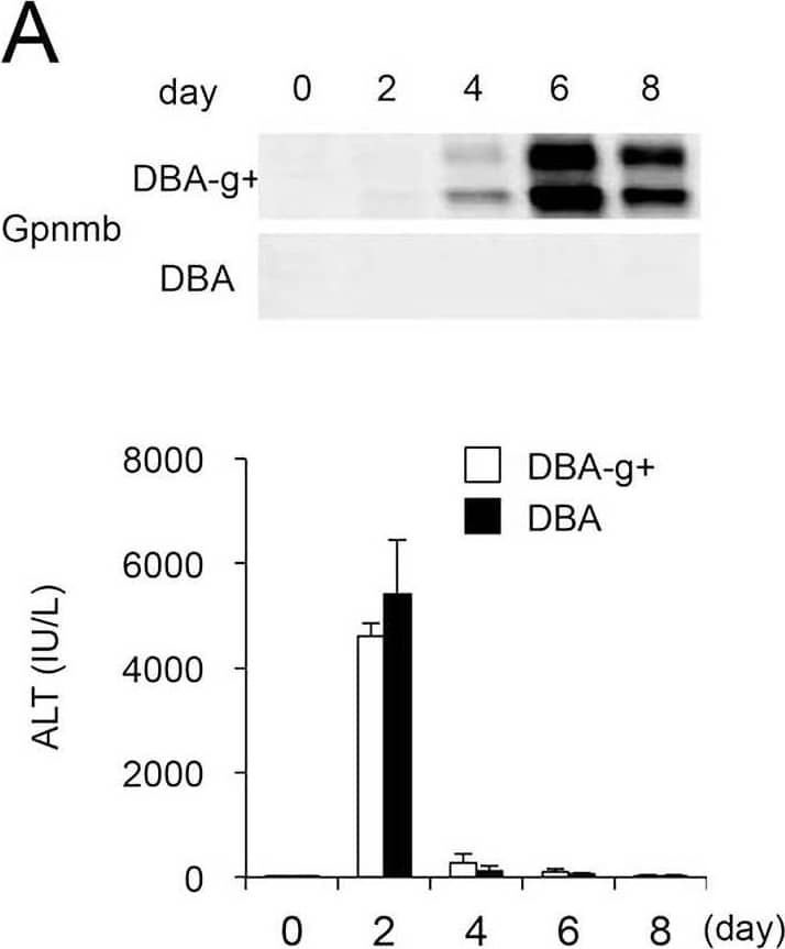 Features of DBA-g+ and DBA mice.(A) Expression of Gpnmb is observed in DBA-g+ but not DBA mice following a single injection of CCl4. However, (B) sequential changes in serum ALT levels and the degree of liver injury are not affected by the lack of Gpnmb-positive macrophages (original magnification, x100). Conversely, (C) the areas of fibrosis and (D) the number of  alpha -SMA-positive cells are significantly decreased in the liver tissues of DBA mice compared to DBA-g+ mice (original magnification, x200). Additionally, (E) although lack of Gpnmb-positive macrophages does not affect expression of TGF-beta  or Col1 alpha 1, expression of MMP-9, MMP-13, and TIMP-1 are significantly decreased in mice lacking Gpnmb expression at six or eight days after single injection of CCl4. Values are mean ± SEM (n = 4). * P < 0.05 (Mann-Whitney U test). Image collected and cropped by CiteAb from the following open publication (//pubmed.ncbi.nlm.nih.gov/26599547), licensed under a CC-BY license. Not internally tested by R&D Systems.