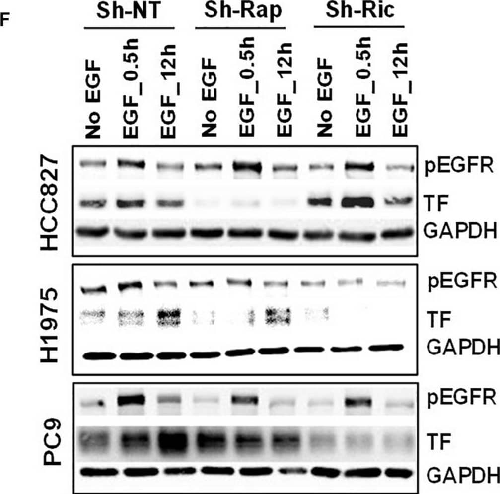 Western Blot Coagulation Factor III/Tissue Factor Antibody (323514) [Unconjugated]