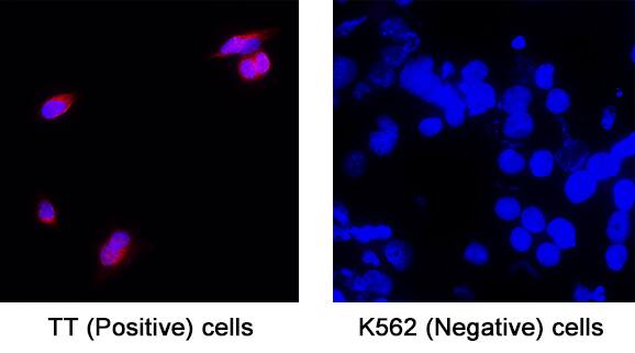 Immunocytochemistry Somatostatin Antibody (906552) [Unconjugated]