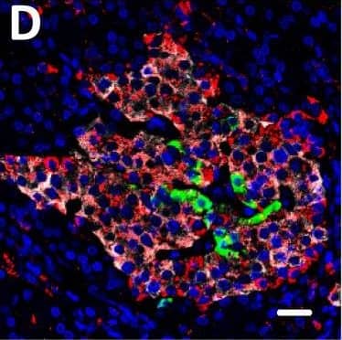 Immunohistochemistry DPP6 Antibody (274308) [Unconjugated]