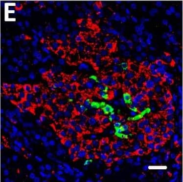 Localization of DPP6 expression in human pancreas. (A–E) A representative human pancreas stained for DPP6 (A, red), insulin (B, white), somatostatin (C, green); overlay of DPP6 (red), insulin (white) and somatostatin (green) (D); overlay of DPP6 (red) and somatostatin (green) (E); the data indicate co-staining of insulin and DPP6, but not somatostatin and DPP6; (F–J) A representative human pancreas stained for glucagon (F, green), DPP6 (G, red), insulin (H, white); DPP6 (red) and glucagon (green) overlay (I); overlay of DPP6 (red), insulin (white) and glucagon (green) (J), the data indicate co-staining of both insulin and glucagon with DPP6; (K) Morphometric quantification of DPP6 area in pancreata from T1D patients as compared to control, non-diabetic individuals (n = 3). (L–P) A representative human pancreas from a subject with long-term type 1 diabetes (16 years of disease) stained for glucagon (L, green), DPP6 (M, red), insulin (N, white); Hoechst (O, blue); (P) overlay of DPP6 (green), glucagon (red), insulin (white) and Hoechst (blue), indicating that in the absence of insulin positive cells, the remaining glucagon positive cells co-stain for DPP6. In total, 3 pancreata from normoglycemic individuals and 3 from type 1 diabetes subjects were analysed. White scale bar represents 20 µm. Image collected and cropped by CiteAb from the following open publication (//pubmed.ncbi.nlm.nih.gov/29123178), licensed under a CC-BY license. Not internally tested by R&D Systems.