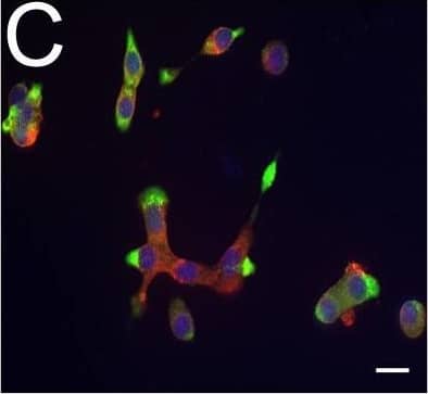 Expression of DPP6 in human islets and EndoC-beta H1 cells and other tissues evaluated by qPCR and histology. (A) Quantitative RT-PCR (qPCR) of DPP6 mRNA expression (detecting a shared sequence among all DPP6 splice variants) in EndoC-beta H1 cells (n = 5) and human pancreatic islets (n = 4) that were exposed or not to cytokines (IL-1 beta  + IFN-gamma ) for 48 h, as compared to pancreatic exocrine tissue (n = 6), two exocrine cell lines (Capan-2 (n = 3) and PANC (n = 3)), and 14 other non-pathological human tissues (n = 1). (B) Immunoblot of EndoC-beta H1 cells under control conditions or following a 48h exposure to cytokines (IL-1 beta  and IFN-gamma ), with alpha-tubulin as a reference protein. A representative figure is shown at the top and densitometric analysis at the bottom (n = 5), this figure displays a cropped blot, the full-length version is included in supplementary figure 8; (C–F) Immunocytochemistry of EndoC-beta H1 cells. (C) An overlay with cells stained with an anti-DPP6 monoclonal antibody (mAb, red), co-stained for insulin (green) and Hoechst in blue. The separate channels are displayed in (D) insulin (green) and (E) DPP6 (red) (n = 3). The mostly surface localization of DPP6 (red) can be observed in (F) (n = 4), with blue signals indicating Hoechst staining. The negative staining control of EndoC-beta H1 cells (without the DPP6 antibody) is placed in the top right corner of panel F. White scale bar represents 1 µm. RT-qPCR and the western blot data are presented as means ± SEM. Paired and unpaired two-way ANOVA (indicated with * and $, respectively), and unpaired one-way ANOVA (indicated with #) with Šídák correction for multiple comparisons; *, $ and # p ≤ 0.05 as indicated by bars. Image collected and cropped by CiteAb from the following open publication (//pubmed.ncbi.nlm.nih.gov/29123178), licensed under a CC-BY license. Not internally tested by R&D Systems.