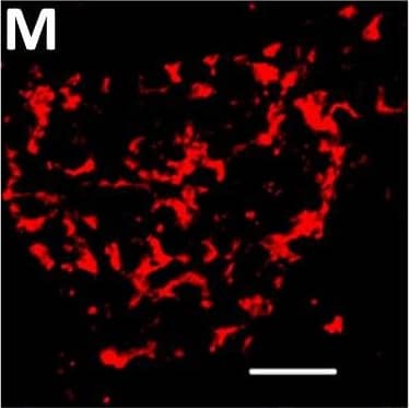 Localization of DPP6 expression in human pancreas. (A–E) A representative human pancreas stained for DPP6 (A, red), insulin (B, white), somatostatin (C, green); overlay of DPP6 (red), insulin (white) and somatostatin (green) (D); overlay of DPP6 (red) and somatostatin (green) (E); the data indicate co-staining of insulin and DPP6, but not somatostatin and DPP6; (F–J) A representative human pancreas stained for glucagon (F, green), DPP6 (G, red), insulin (H, white); DPP6 (red) and glucagon (green) overlay (I); overlay of DPP6 (red), insulin (white) and glucagon (green) (J), the data indicate co-staining of both insulin and glucagon with DPP6; (K) Morphometric quantification of DPP6 area in pancreata from T1D patients as compared to control, non-diabetic individuals (n = 3). (L–P) A representative human pancreas from a subject with long-term type 1 diabetes (16 years of disease) stained for glucagon (L, green), DPP6 (M, red), insulin (N, white); Hoechst (O, blue); (P) overlay of DPP6 (green), glucagon (red), insulin (white) and Hoechst (blue), indicating that in the absence of insulin positive cells, the remaining glucagon positive cells co-stain for DPP6. In total, 3 pancreata from normoglycemic individuals and 3 from type 1 diabetes subjects were analysed. White scale bar represents 20 µm. Image collected and cropped by CiteAb from the following open publication (//pubmed.ncbi.nlm.nih.gov/29123178), licensed under a CC-BY license. Not internally tested by R&D Systems.