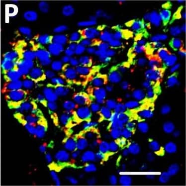 Localization of DPP6 expression in human pancreas. (A–E) A representative human pancreas stained for DPP6 (A, red), insulin (B, white), somatostatin (C, green); overlay of DPP6 (red), insulin (white) and somatostatin (green) (D); overlay of DPP6 (red) and somatostatin (green) (E); the data indicate co-staining of insulin and DPP6, but not somatostatin and DPP6; (F–J) A representative human pancreas stained for glucagon (F, green), DPP6 (G, red), insulin (H, white); DPP6 (red) and glucagon (green) overlay (I); overlay of DPP6 (red), insulin (white) and glucagon (green) (J), the data indicate co-staining of both insulin and glucagon with DPP6; (K) Morphometric quantification of DPP6 area in pancreata from T1D patients as compared to control, non-diabetic individuals (n = 3). (L–P) A representative human pancreas from a subject with long-term type 1 diabetes (16 years of disease) stained for glucagon (L, green), DPP6 (M, red), insulin (N, white); Hoechst (O, blue); (P) overlay of DPP6 (green), glucagon (red), insulin (white) and Hoechst (blue), indicating that in the absence of insulin positive cells, the remaining glucagon positive cells co-stain for DPP6. In total, 3 pancreata from normoglycemic individuals and 3 from type 1 diabetes subjects were analysed. White scale bar represents 20 µm. Image collected and cropped by CiteAb from the following open publication (//pubmed.ncbi.nlm.nih.gov/29123178), licensed under a CC-BY license. Not internally tested by R&D Systems.