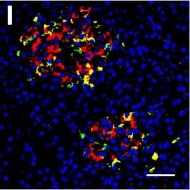 Immunohistochemistry DPP6 Antibody (274308) [Unconjugated]