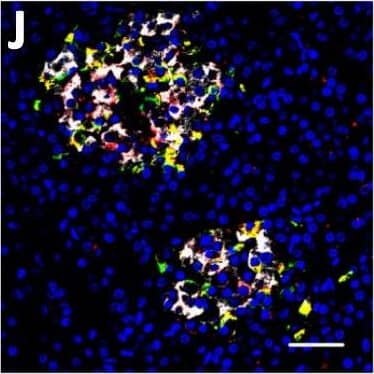 Localization of DPP6 expression in human pancreas. (A–E) A representative human pancreas stained for DPP6 (A, red), insulin (B, white), somatostatin (C, green); overlay of DPP6 (red), insulin (white) and somatostatin (green) (D); overlay of DPP6 (red) and somatostatin (green) (E); the data indicate co-staining of insulin and DPP6, but not somatostatin and DPP6; (F–J) A representative human pancreas stained for glucagon (F, green), DPP6 (G, red), insulin (H, white); DPP6 (red) and glucagon (green) overlay (I); overlay of DPP6 (red), insulin (white) and glucagon (green) (J), the data indicate co-staining of both insulin and glucagon with DPP6; (K) Morphometric quantification of DPP6 area in pancreata from T1D patients as compared to control, non-diabetic individuals (n = 3). (L–P) A representative human pancreas from a subject with long-term type 1 diabetes (16 years of disease) stained for glucagon (L, green), DPP6 (M, red), insulin (N, white); Hoechst (O, blue); (P) overlay of DPP6 (green), glucagon (red), insulin (white) and Hoechst (blue), indicating that in the absence of insulin positive cells, the remaining glucagon positive cells co-stain for DPP6. In total, 3 pancreata from normoglycemic individuals and 3 from type 1 diabetes subjects were analysed. White scale bar represents 20 µm. Image collected and cropped by CiteAb from the following open publication (//pubmed.ncbi.nlm.nih.gov/29123178), licensed under a CC-BY license. Not internally tested by R&D Systems.