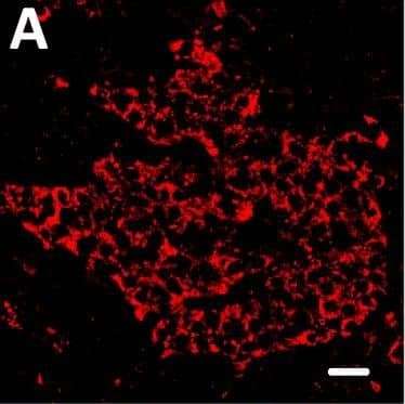 Localization of DPP6 expression in human pancreas. (A–E) A representative human pancreas stained for DPP6 (A, red), insulin (B, white), somatostatin (C, green); overlay of DPP6 (red), insulin (white) and somatostatin (green) (D); overlay of DPP6 (red) and somatostatin (green) (E); the data indicate co-staining of insulin and DPP6, but not somatostatin and DPP6; (F–J) A representative human pancreas stained for glucagon (F, green), DPP6 (G, red), insulin (H, white); DPP6 (red) and glucagon (green) overlay (I); overlay of DPP6 (red), insulin (white) and glucagon (green) (J), the data indicate co-staining of both insulin and glucagon with DPP6; (K) Morphometric quantification of DPP6 area in pancreata from T1D patients as compared to control, non-diabetic individuals (n = 3). (L–P) A representative human pancreas from a subject with long-term type 1 diabetes (16 years of disease) stained for glucagon (L, green), DPP6 (M, red), insulin (N, white); Hoechst (O, blue); (P) overlay of DPP6 (green), glucagon (red), insulin (white) and Hoechst (blue), indicating that in the absence of insulin positive cells, the remaining glucagon positive cells co-stain for DPP6. In total, 3 pancreata from normoglycemic individuals and 3 from type 1 diabetes subjects were analysed. White scale bar represents 20 µm. Image collected and cropped by CiteAb from the following open publication (//pubmed.ncbi.nlm.nih.gov/29123178), licensed under a CC-BY license. Not internally tested by R&D Systems.