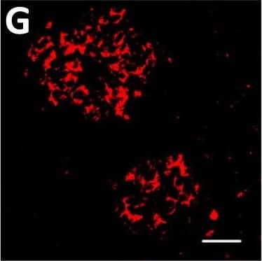 Localization of DPP6 expression in human pancreas. (A–E) A representative human pancreas stained for DPP6 (A, red), insulin (B, white), somatostatin (C, green); overlay of DPP6 (red), insulin (white) and somatostatin (green) (D); overlay of DPP6 (red) and somatostatin (green) (E); the data indicate co-staining of insulin and DPP6, but not somatostatin and DPP6; (F–J) A representative human pancreas stained for glucagon (F, green), DPP6 (G, red), insulin (H, white); DPP6 (red) and glucagon (green) overlay (I); overlay of DPP6 (red), insulin (white) and glucagon (green) (J), the data indicate co-staining of both insulin and glucagon with DPP6; (K) Morphometric quantification of DPP6 area in pancreata from T1D patients as compared to control, non-diabetic individuals (n = 3). (L–P) A representative human pancreas from a subject with long-term type 1 diabetes (16 years of disease) stained for glucagon (L, green), DPP6 (M, red), insulin (N, white); Hoechst (O, blue); (P) overlay of DPP6 (green), glucagon (red), insulin (white) and Hoechst (blue), indicating that in the absence of insulin positive cells, the remaining glucagon positive cells co-stain for DPP6. In total, 3 pancreata from normoglycemic individuals and 3 from type 1 diabetes subjects were analysed. White scale bar represents 20 µm. Image collected and cropped by CiteAb from the following open publication (//pubmed.ncbi.nlm.nih.gov/29123178), licensed under a CC-BY license. Not internally tested by R&D Systems.