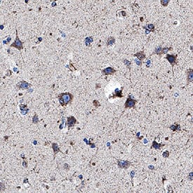 Immunohistochemistry LRP-1B Antibody (1034124) [Unconjugated]