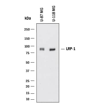 Western Blot LRP-1B Antibody (1034124) [Unconjugated]