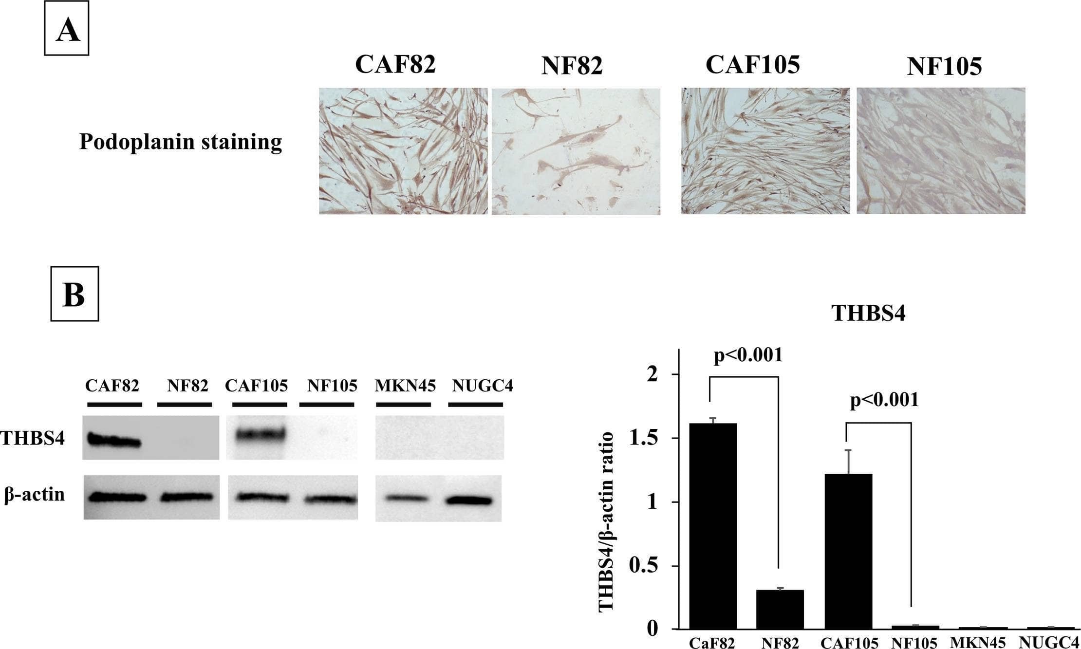 Immunohistochemistry Thrombospondin-4 Antibody (276523)
