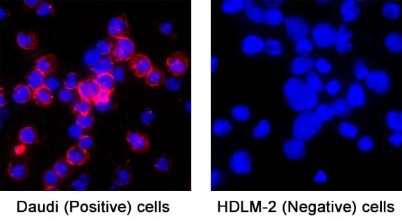 CD38 was detected in immersion fixed Daudi Human Burkitt's Lymphoma Cell Line (positive) and HDLM‑2 Human Hodgkin’s Lymphoma Cell Line (negative) Cells using Mouse Anti-Human CD38 Monoclonal Antibody (Catalog # MAB2404) at 5 &micro;g/mL for 3 hours at room temperature. Cells were stained using the NorthernLights&trade; 557-conjugated Anti-Mouse IgG Secondary Antibody (red; Catalog # NL007) and counterstained with DAPI (blue). Specific staining was localized to cell surface and cytoplasm. View our protocol for Fluorescent ICC Staining of Non-adherent Cells.