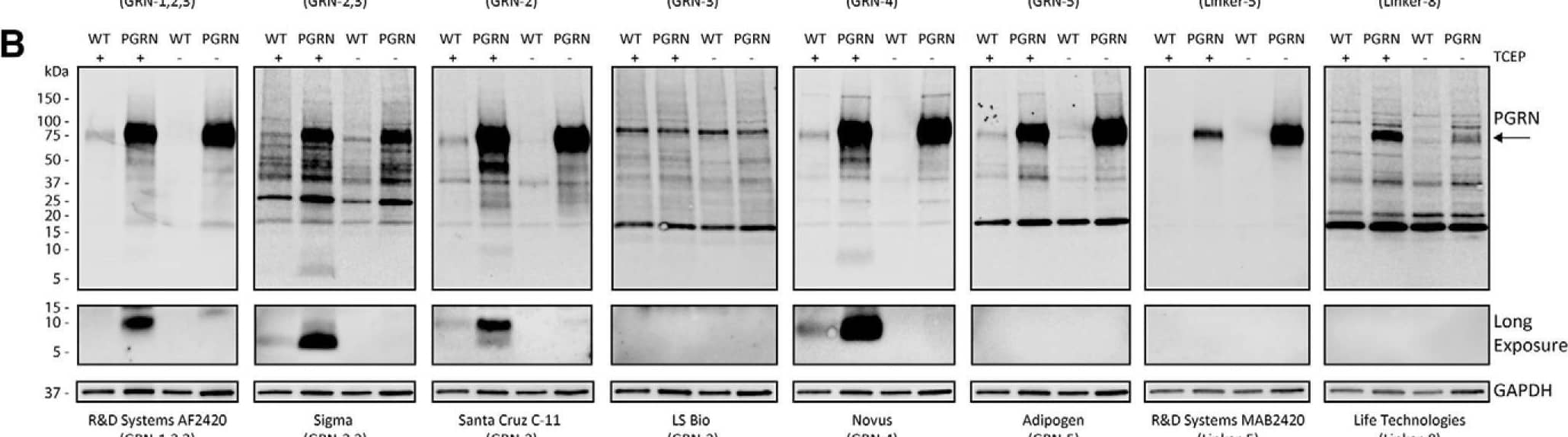Western Blot Progranulin/PGRN Antibody (296628) [Unconjugated]