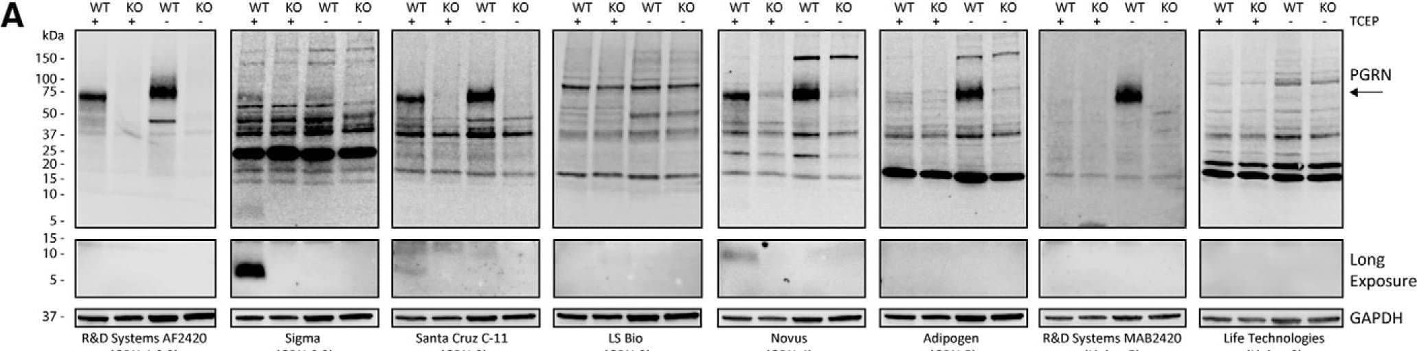 Western Blot Progranulin/PGRN Antibody (296628) [Unconjugated]