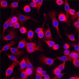 IL‑15 was detected in immersion fixed using Mouse Anti-Human IL‑15 Monoclonal Antibody (Catalog # MAB2472) at 8 &micro;g/mL for 3 hours at room temperature. Cells were stained using the NorthernLights&trade; 557-conjugated Anti-Mouse IgG Secondary Antibody (red; Catalog # NL007) and counterstained with DAPI (blue). Specific staining was localized to cytoplasm. View our protocol for Fluorescent ICC Staining of Cells on Coverslips.