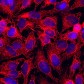 IL‑15 was detected in immersion fixed HeLa cells (human) using Mouse Anti-Human IL‑15 Monoclonal Antibody (Catalog # MAB2472) at 8 &micro;g/mL for 3 hours at room temperature. Cells were stained using the NorthernLights&trade; 557-conjugated Anti-Mouse IgG Secondary Antibody (red; Catalog # NL007) and counterstained with DAPI (blue). Specific staining was localized to cytoplasm. View our protocol for Fluorescent ICC Staining of Cells on Coverslips.