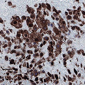 IL‑15 was detected in immersion fixed paraffin-embedded sections of human placenta using Mouse Anti-Human IL‑15 Monoclonal Antibody (Catalog # MAB2472) at 5 &micro;g/mL for 1 hour at room temperature followed by incubation with the Anti-Mouse IgG VisUCyte&trade; HRP Polymer Antibody (Catalog # VC001). Before incubation with the primary antibody, tissue was subjected to heat-induced epitope retrieval using VisUCyte Antigen Retrieval Reagent-Basic (Catalog # VCTS021). Tissue was stained using DAB (brown) and counterstained with hematoxylin (blue). Specific staining was localized to cytoplasm and nuclei in decidual cells. View our protocol for IHC Staining with VisUCyte HRP Polymer Detection Reagents.